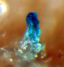 « » Bacillus subtilis —   ,      ,    —   (   gasp.med.harvard.edu)
