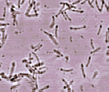    Desulfitobacterium — D. hafniense (   genome.jgi-psf.org)