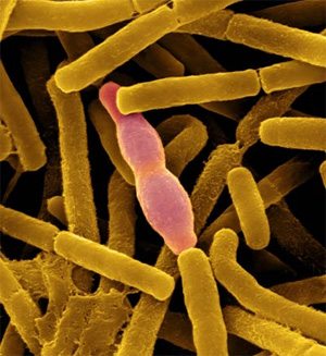            
       (     ). : Dennis Kunkel Microscopy, Inc./Dennis Kunkel