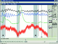  -  . Polygraph. .2